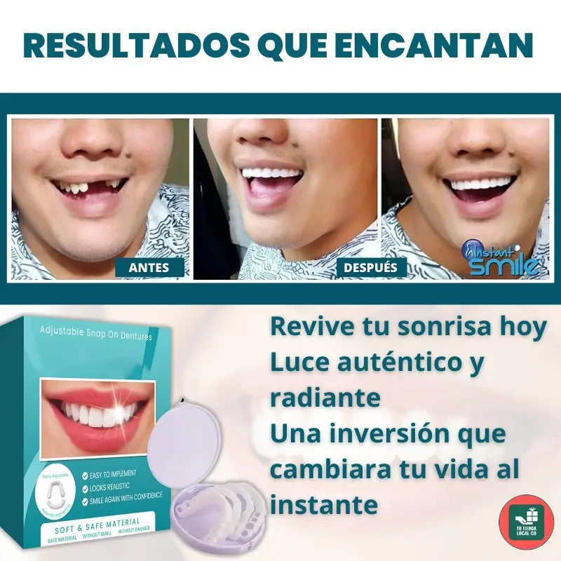 CARILLAS DENTALES SNAP ON DENTURE UN CAMBIO QUE TRANSFORMA TU VIDA AL INSTANTE